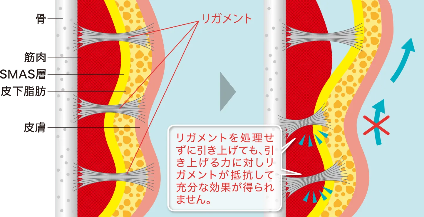 イメージ1