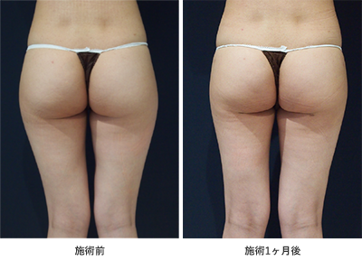 施術前後